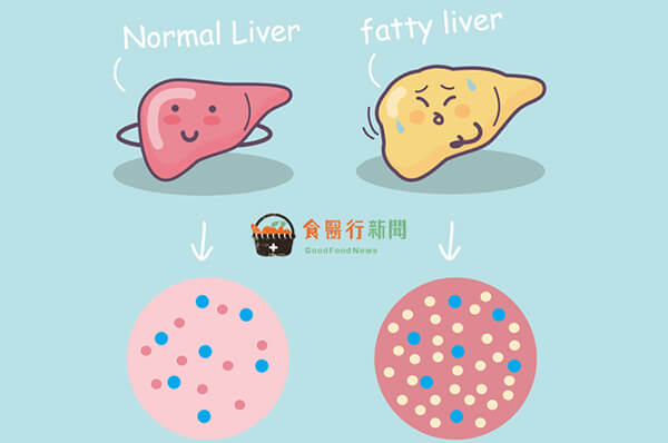 【脂肪肝】救救脂肪肝！營養師：5大食物護肝燃脂找回健康肝
